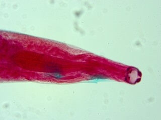 parasite by microscope in a laboratory