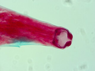 parasite by microscope in a laboratory