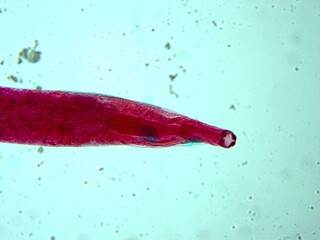 parasite by microscope in a laboratory
