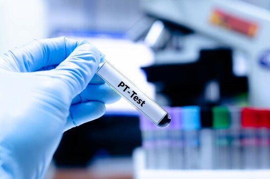 Blood sampling tube for prothrombin time analysis.