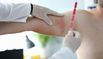Close-up of medical worker hand holding stick with different types of red colour to define patients...