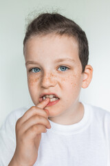 A boy is putting on clear teeth alignment bracket