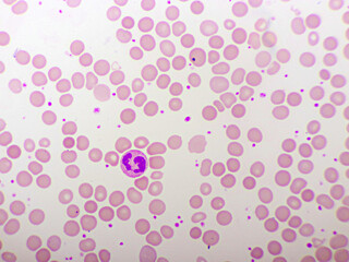 Segmented neutrophil cell in human blood smear, analyze by microscope, original magnification 1000x