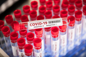 Test tube with blood for 2019 Covid 19 analyzing