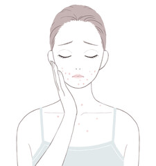 大人ニキビに悩む女性