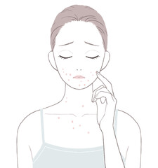 大人ニキビに悩む女性