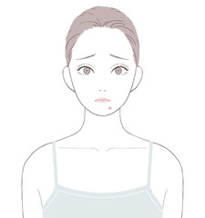あごニキビに悩む女性
