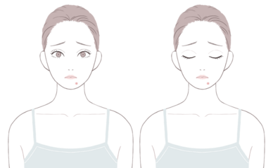 あごニキビに悩む女性