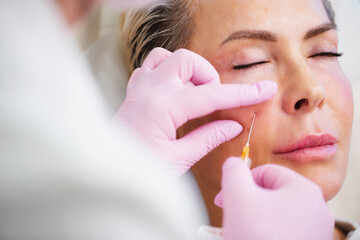Subcutaneous injections of fillers with a syringe in a medical salon - aesthetic medicine procedure...