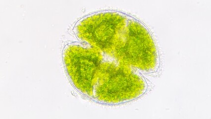 Freshwater phytoplankton or microalgae genus Cosmarium. The species is probably Cosmarium obsoletum.