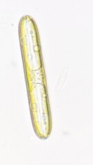 Freshwater diatom, Pinnularia sp. Live cell. Selective focus image