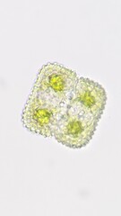 Freshwater green microalgae. The species is probably Cosmarium margaritatum. Live cell. Selective focus