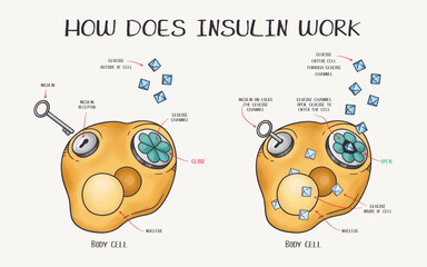 Hand drawn vector illustration explaining how does insulin work - obrazy, fototapety, plakaty