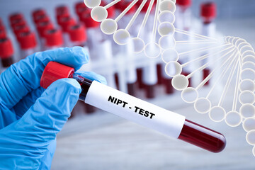 Noninvasive prenatal testing (NIPT). Nurse holding test tube with blood sample in laboratory,...