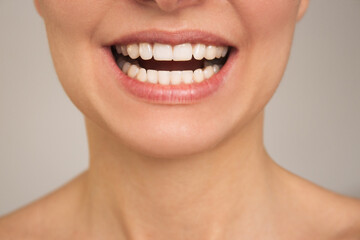 close-up photo of beautiful natural smooth white female teeth. Dentistry and orthodontics. The...