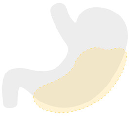 Visceral fat icon, type of obesity. Fat inside the human body that surrounds the organs. Adipose tissue internal mass around the stomach, abdominal cavity area. Pictogram medical vector illustration. 