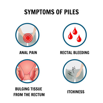 Symptoms of piles hemorrhoids in vector