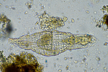 rotifer in a soil sample