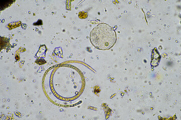 living soil life in a soil sample under the microscope