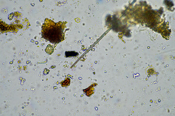 fungal hyphae on a soil sample on a farm. fungi storing carbon in the soil - obrazy, fototapety, plakaty