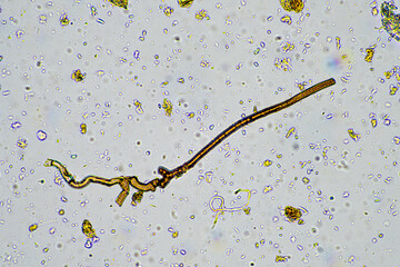 fungal hyphae on a soil sample on a farm. fungi storing carbon in the soil