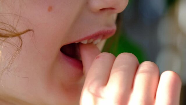 The child shakes the front baby tooth and smiles a toothless smile close-up. Changing teeth to molars in childhood