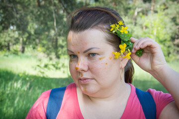 In the summer in the forest, the girl smeared herself with celandine.