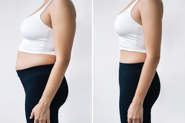 Two shots of a woman in profile with a belly with excess fat and toned slim stomach before and after losing weight on gray background. Result of diet, liposuction, training. Getting rid of overweight - obrazy, fototapety, plakaty