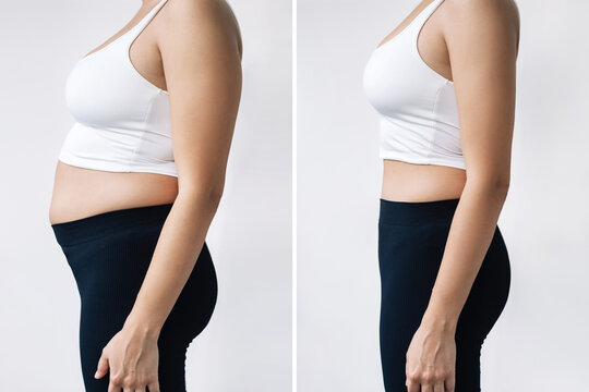 Two shots of a woman in profile with a belly with excess fat and toned slim stomach before and after losing weight on gray background. Result of diet, liposuction, training. Getting rid of overweight