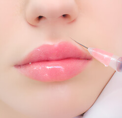Woman wearing lip gloss receiving lip filler injection cosmetic procedure