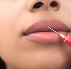 Lip filler injection cosmetic procedure for fuller lips