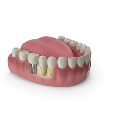 Mandibular human gum and teeth. Medically accurate tooth 3D illustration, Mouth gum and teeth. Medically accurate tooth 3D illustration