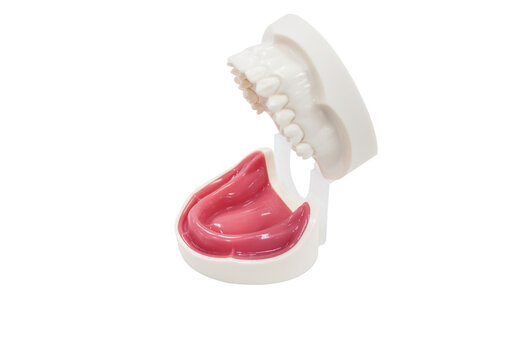dental implant practice model