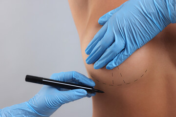 Breast augmentation. Doctor with marker preparing woman for plastic surgery operation against light...