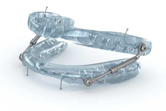 Oral appliance therapy device, sleep apnea treatment.3D illustration