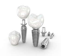 Dental implant concept design. Dental 3D illustration - 632930866