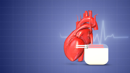 Cardiac pacemaker heartbeat wave insert - obrazy, fototapety, plakaty