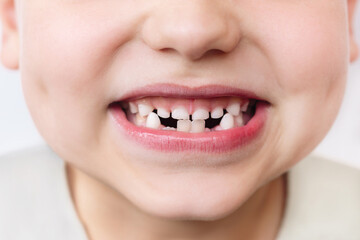 Cropped shot of the kid who lost two teeth on a white background. Baby without a tooth. Portrait of...