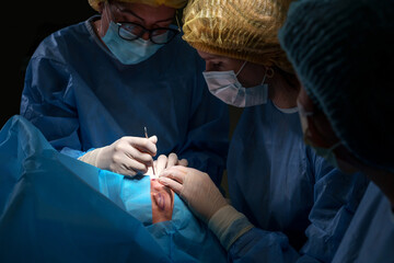 Blepharoplasty plastic surgery. Rejuvenation of the area around the eyes