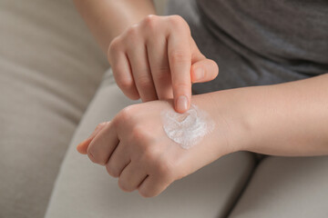 Woman applying ointment onto her hand, closeup
