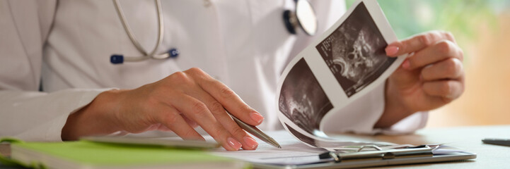 Female doctor working with ultrasound results of patients at her working desk.