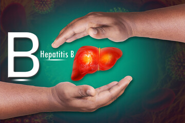 Hepatitis B virus infection. Liver disease. 3d illustration - obrazy, fototapety, plakaty