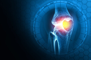 Pain in knee joint. Tendon problems and Joint inflammation on dark background. 3d illustration - obrazy, fototapety, plakaty