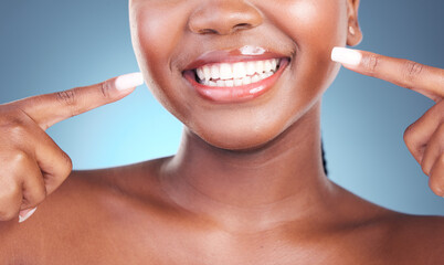 Happy woman, teeth and pointing in dental cleaning, hygiene or treatment against a blue studio background. Closeup of female person mouth in tooth whitening, oral and gum care with big smile