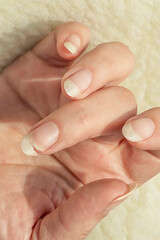 Broken nail. Natural long nails without polish. Cracked, chipped nail. Female fingernails polish-free.