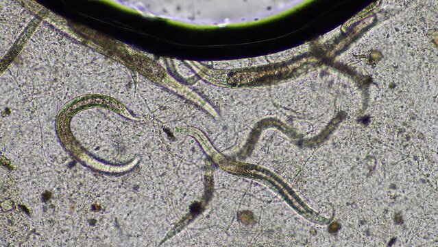 bacterial feeding soil nematode in a soil sample under the microscope