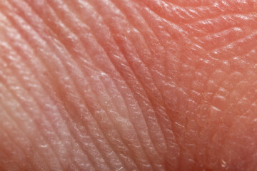 Skin diseases concept. macrophotograph of human skin under microscope, manified 5x. Medicine and...