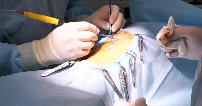 A veterinary surgeon stops bleeding with an electrocautery during surgery on an animal. The surgeon cauterizes small blood vessels in a pet in the operating room. The concept of veterinary surgery.