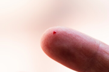 Small wound on the tip of the index finger from which blood is oozing. Method to check blood sugar for diabetes.