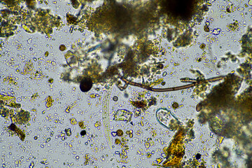 agronomist with a soil sample with soil life and bugs. microorganisms storing carbon with fungi and bacteria